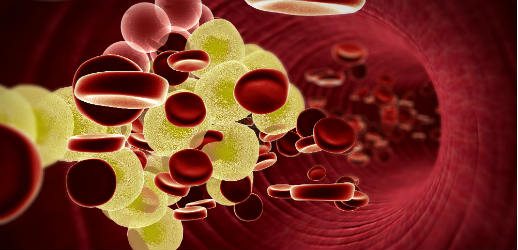 Repatha in i högkostnadsskyddet