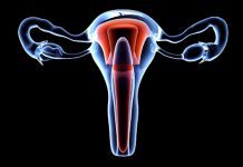 Ny hjälp vid livmoderhalscancer