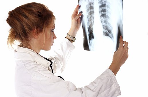 Framgångar för lungcancerbehandlingar