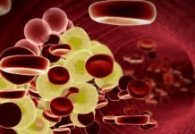 Kolesterol-vaccin rycker närmare klinik