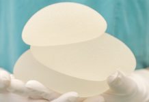 Dödsfall av cancer från bröstimplantat