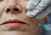 Täpper till förmånslucka för botox mot rynkor Läkemedelsvärlden