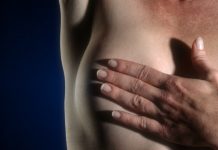 RNA-sekvensering nytt verktyg vid bröstcancer Läkemedelsvärlden