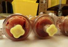 Behov av blodförtunnande vid dialys kan halveras