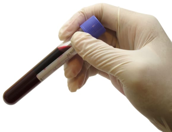 Forskare vill öka etnisk variation i biobanker