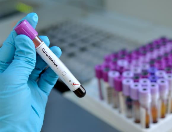 EU:s smittskydd i högsta beredskap för covid-19