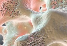 ”Utred och behandla fler bensköra” Läkemedelsvärlden