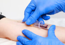 Nästan alla svenskar har antikroppar mot covid-19 Blodet, prov, covid-19