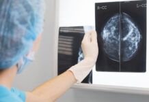 Forskare: AI redo bli klinisk rutin i mammografin Läkemedelsvärlden