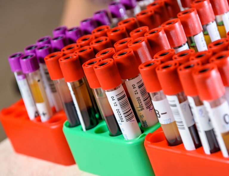 Akademiskas laboratorium är underbemannat